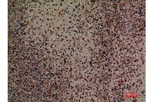 Immunohistochemistry (IHC) image for anti-Protein C Receptor, Endothelial (PROCR) (Internal Region) antibody (ABIN3187808)