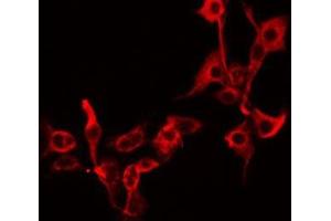 ABIN6279255 staining A549 by IF/ICC. (CPZ Antikörper  (Internal Region))