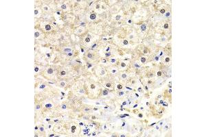 Immunohistochemistry of paraffin-embedded human liver injury using FKBP4 Antibody (ABIN5973289) at dilution of 1/200 (40x lens). (FKBP4 Antikörper)