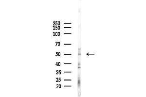 anti-Zinc Finger Protein 485 (ZNF485) antibody