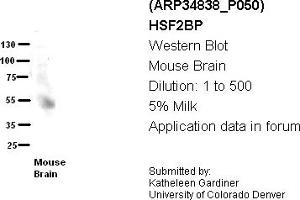 Image no. 1 for anti-Heat Shock Transcription Factor 2 Binding Protein (HSF2BP) (N-Term) antibody (ABIN2776048) (HSF2BP Antikörper  (N-Term))