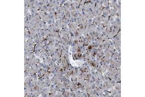 Immunohistochemical staining of human liver with SLC47A1 polyclonal antibody  shows strong positivity in Kupffer cells at 1:50-1:200 dilution.