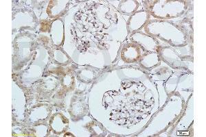 Formalin-fixed and paraffin embedded rat kidney labeled with Anti-HB EGF Polyclonal Antibody, Unconjugated (ABIN701050) at 1:200 followed by conjugation to the secondary antibody and DAB staining (HBEGF Antikörper  (AA 51-150))