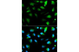 Immunofluorescence analysis of HeLa cell using F11R antibody. (F11R Antikörper  (AA 30-238))