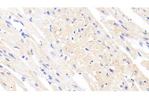 Detection of FECH in Human Cardiac Muscle Tissue using Polyclonal Antibody to Ferrochelatase (FECH) (FECH Antikörper  (AA 55-423))