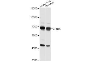 Western blot analysis of extracts of various cell lines, using CPNE6 antibody (ABIN6291377) at 1:3000 dilution.