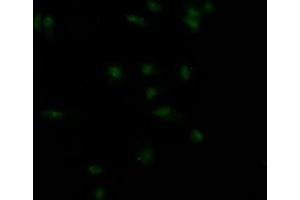 Immunofluorescence staining of MCF7 Cells with ABIN7127575 at 1:50, counter-stained with DAPI. (Rekombinanter Insulin Receptor Antikörper)