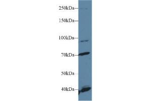 Western Blot; Sample: Human Hela cell lysate; Primary Ab: 1µg/ml Rabbit Anti-Human FGFR2 Antibody Second Ab: 0. (FGFR2 Antikörper  (AA 157-377))