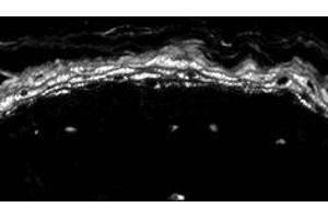 Immunohistochemistry (IHC) image for anti-Sodium Channel, Voltage-Gated, Type X, alpha Subunit (SCN10A) (C-Term) antibody (ABIN6658124)
