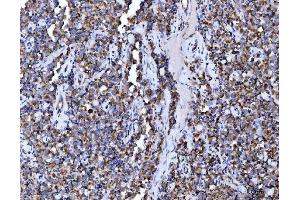 IHC analysis of Aconitase 2 using anti-Aconitase 2 antibody (ABIN7602770). (ACO2 Antikörper  (C-Term))