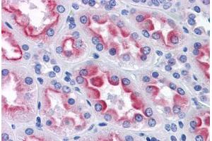 Immunohistochemistry (Formalin-fixed Paraffin-embedded Sections) (IHC (fp)) image for anti-Aldo-Keto Reductase Family 1, Member B10 (Aldose Reductase) (AKR1B10) (AA 76-144) antibody (ABIN574456)