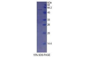 SDS-PAGE (SDS) image for Spondin 2 (SPON2) (AA 119-331) protein (His tag,GST tag) (ABIN1879759)