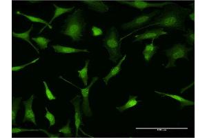 Immunofluorescence of monoclonal antibody to PURA on HeLa cell. (PURA Antikörper  (AA 183-292))