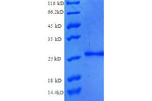 SDS-PAGE (SDS) image for Nucleoporin 210kDa (NUP210) (AA 28-238), (partial) protein (His tag) (ABIN5710035) (NUP210 Protein (AA 28-238, partial) (His tag))