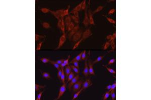 Immunofluorescence (IF) image for anti-Glutamate-Ammonia Ligase (GLUL) (AA 1-373) antibody (ABIN6141161)