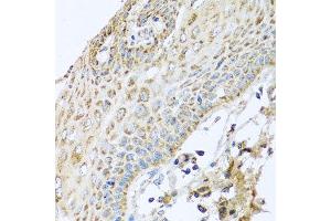 Immunohistochemistry of paraffin-embedded human esophagus using NDUFA2 antibody at dilution of 1:100 (x40 lens). (NDUFA2 Antikörper)