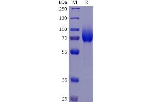Human CSF1R Protein, His Tag on SDS-PAGE under reducing condition.
