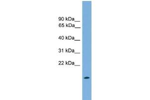 WB Suggested Anti-RAB9A Antibody Titration:  0. (RAB9A Antikörper  (Middle Region))