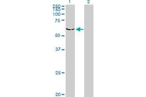 Western Blot analysis of DYRK2 expression in transfected 293T cell line by DYRK2 monoclonal antibody (M01), clone 3G5. (DYRK2 Antikörper  (AA 1-100))