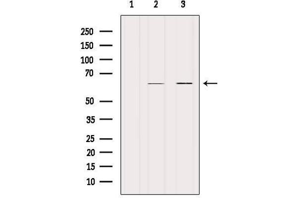 KRT9 Antikörper  (Internal Region)