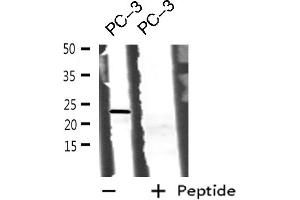 Western blot analysis of BOK using PC-3 whole cell lysates (BOK Antikörper  (N-Term))
