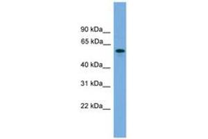 Image no. 1 for anti-MTOR associated protein, eak-7 homolog (MEAK7) (C-Term) antibody (ABIN6746516) (KIAA1609 Antikörper  (C-Term))