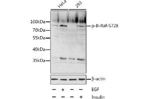 Western blot analysis of extracts of various cell lines, using Phospho-B-Raf-S728 antibody (ABIN6135192, ABIN6136028, ABIN6136029 and ABIN6225598). (BRAF Antikörper  (pSer728))