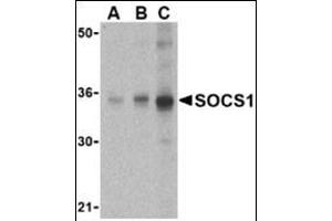 Western blot analysis of SOCS1 in Human spleen cell lysate with this product at (A) 1, (B) 2 and (C) 4 μg/ml. (SOCS1 Antikörper  (N-Term))