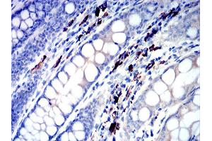 Immunohistochemical analysis of paraffin-embedded colon tissues using IGLC2 mouse mAb with DAB staining.