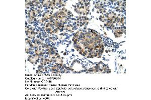 Human Pancreas (ZNF555 Antikörper  (N-Term))