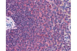 Anti-MDA5 antibody IHC of human spleen. (IFIH1 Antikörper  (AA 612-661))