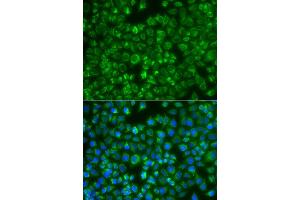 Immunofluorescence analysis of A549 cell using MTMR4 antibody. (MTMR4 Antikörper)