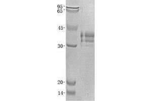 Validation with Western Blot (LTBR Protein (His tag))