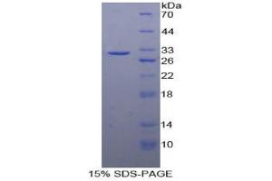 SDS-PAGE analysis of Human Cadherin 5 Protein.