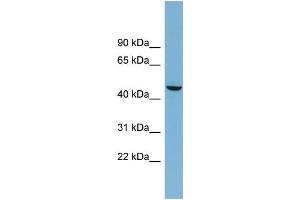 Human OVCAR-3; WB Suggested Anti-ALPPL2 Antibody Titration: 0. (ALPPL2 Antikörper  (Middle Region))