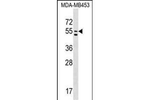 PTDSS1 Antibody (C-term) (ABIN1537254 and ABIN2848773) western blot analysis in MDA-M cell line lysates (35 μg/lane). (PTDSS1 Antikörper  (C-Term))