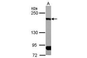 Image no. 1 for anti-CAP-GLY Domain Containing Linker Protein 1 (CLIP1) (N-Term) antibody (ABIN1494006) (CLIP1 Antikörper  (N-Term))