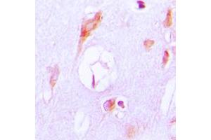 Immunohistochemistry (IHC) image for anti-Cytochrome P450, Family 27, Subfamily A, Polypeptide 1 (CYP27A1) (Center) antibody (ABIN7295472)