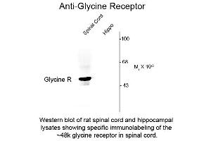 Western Blot of Anti-Glycine Receptor (Rabbit) Antibody - 600-401-D65 Western Blot of Rabbit anti-Glycine Receptor antibody. (Glycine Receptor (GRD) (N-Term) Antikörper)