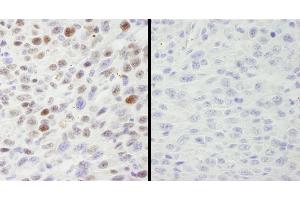 Immunohistochemistry (IHC) image for anti-Minichromosome Maintenance Complex Component 2 (MCM2) (pSer40), (pSer41) antibody (ABIN7448650) (MCM2 Antikörper  (pSer40, pSer41))