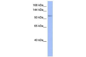 MSH4 antibody used at 1 ug/ml to detect target protein. (MSH4 Antikörper)