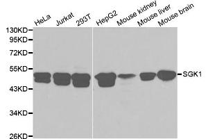 Western blot analysis of extracts of various cell lines, using SGK1 antibody (ABIN5970402) at 1/1000 dilution. (SGK1 Antikörper)