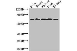 Western Blot Positive WB detected in: Hela whole cell lysate, Mouse heart tissue, Mouse spleen tissue, Mouse lung tissue, Mouse kidney tissue All lanes: ENTPD7 antibody at 2. (ENTPD7 Antikörper  (AA 51-350))
