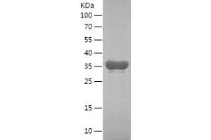 Western Blotting (WB) image for Insulin-Like Growth Factor 2 mRNA Binding Protein 3 (IGF2BP3) (AA 284-579) protein (His tag) (ABIN7123456) (IGF2BP3 Protein (AA 284-579) (His tag))