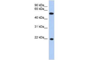 WB Suggested Anti-CRYGC Antibody Titration: 0. (CRYGC Antikörper  (Middle Region))