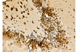 ABIN6262409 and ABIN6276925 at 1/100 staining Mouse testis tissue by IHC-P.