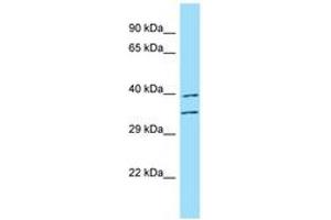 Image no. 1 for anti-Fucosyltransferase 3 (Galactoside 3(4)-L-Fucosyltransferase, Lewis Blood Group) (FUT3) (AA 278-327) antibody (ABIN6748477) (FUT3 Antikörper  (AA 278-327))