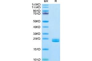 Human IL-11 on Tris-Bis PAGE under reduced condition. (IL-11 Protein (AA 22-199) (His tag))