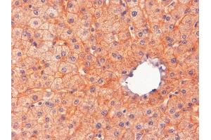 Immunohistochemistry (IHC) image for anti-Ectonucleotide Pyrophosphatase/phosphodiesterase 1 (ENPP1) (C-Term) antibody (ABIN185487)