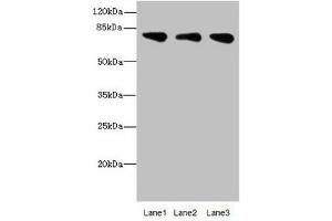 ACSS2 antibody  (AA 462-701)